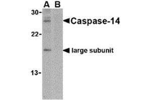 Image no. 1 for anti-Caspase 14, Apoptosis-Related Cysteine Peptidase (CASP14) (C-Term) antibody (ABIN318746)