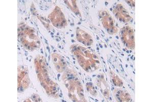 Used in DAB staining on fromalin fixed paraffin- embedded stomach tissue (Cullin 1 Antikörper  (AA 1-250))
