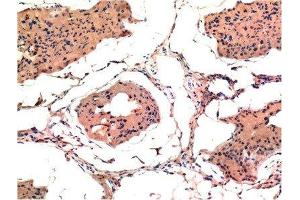 Immunohistochemical analysis of paraffin-embedded Rat Testis Tissue using Bax Mouse mAb diluted at 1:200. (BAX Antikörper)