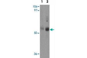Western blot analysis of MFSD2 in rat lung tissue lysate with MFSD2 polyclonal antibody  at (1) 1 and (2) 2 ug/mL. (MFSD2A Antikörper  (C-Term))