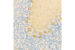 Immunohistochemistry (Paraffin-embedded Sections) (IHC (p)) image for anti-Homer Homolog 3 (Drosophila) (HOMER3) antibody (ABIN7074257)