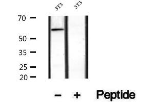 Western blot analysis of extracts of human kidney tissue, using SACM1L antibody. (SACM1L Antikörper  (Internal Region))