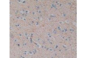 IHC-P analysis of Human Brain Tissue, with DAB staining. (Substance P Antikörper)