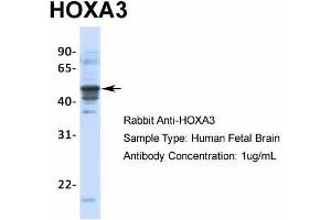 Host:  Rabbit  Target Name:  HOXA3  Sample Type:  Human Fetal Brain  Antibody Dilution:  1. (HOXA3 Antikörper  (C-Term))