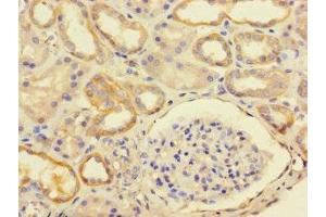 Immunohistochemistry of paraffin-embedded human kidney tissue using ABIN7174731 at dilution of 1:100 (PARP11 Antikörper  (AA 1-245))