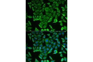 Immunofluorescence (IF) image for anti-Arginyl-tRNA Synthetase (RARS) antibody (ABIN1980323) (RARS Antikörper)