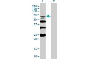 Western Blot analysis of RMI1 expression in transfected 293T cell line by RMI1 MaxPab polyclonal antibody. (RMI1 Antikörper  (AA 1-470))