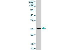 BCAP31 monoclonal antibody (M01), clone 3C5. (BCAP31 Antikörper  (AA 137-246))