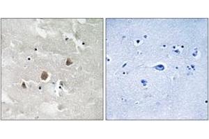 Immunohistochemistry analysis of paraffin-embedded human brain, using MAP3K1 (Phospho-Thr1402) Antibody. (MAP3K1 Antikörper  (pThr1402))