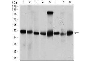 Western Blotting (WB) image for anti-Protein Phosphatase, Mg2+/Mn2+ Dependent, 1A (PPM1A) (AA 202-382) antibody (ABIN969556)