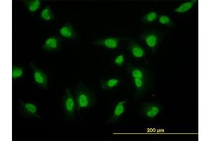 Immunofluorescence of monoclonal antibody to CRSP6 on HeLa cell. (MED17 Antikörper  (AA 551-651))