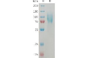 Mouse I Protein, His Tag on SDS-PAGE under reducing condition.