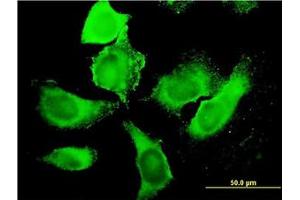 Image no. 3 for anti-phosphoinositide Kinase, FYVE Finger Containing (PIKFYVE) (AA 342-452) antibody (ABIN599337) (PIKFYVE Antikörper  (AA 342-452))