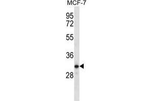 TESSP1 Antibody (Center) western blot analysis in MCF-7 cell line lysates (35 µg/lane). (TESSP1 Antikörper  (Middle Region))