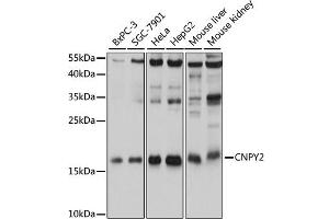 Western blot analysis of extracts of various cell lines, using CNPY2 antibody. (CNPY2/MSAP Antikörper)