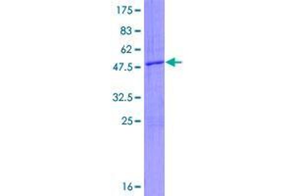 RNF135 Protein (AA 1-210) (GST tag)