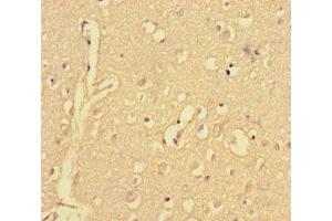 Immunohistochemistry of paraffin-embedded human brain tissue using ABIN7148515 at dilution of 1:100 (Copine II Antikörper  (AA 1-300))