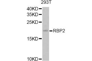 Western blot analysis of extracts of 293T cells, using RBP2 Antibody. (RBP2 Antikörper)