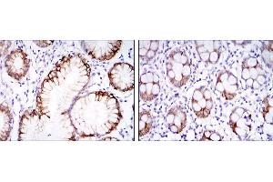 Immunohistochemical analysis of paraffin-embedded stomach tissues (left) and colon tissues (right) using CA9 mouse mAb with DAB staining. (CA9 Antikörper)