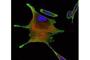 Immunofluorescence (IF) image for anti-Bone Morphogenetic Protein Receptor, Type II (serine/threonine Kinase) (BMPR2) antibody (ABIN968988)