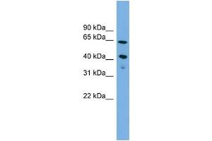 WB Suggested Anti-ATP8B2  Antibody Titration: 0. (ATP8B2 Antikörper  (N-Term))