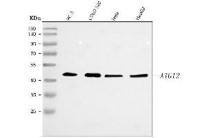 Western blot analysis of ATG12 using anti-ATG12 antibody (ABIN7602293).