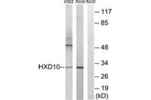 Western blot analysis of extracts from K562/RAW264.