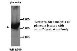 Image no. 1 for anti-Calpain 6 (CAPN6) (C-Term) antibody (ABIN790874)