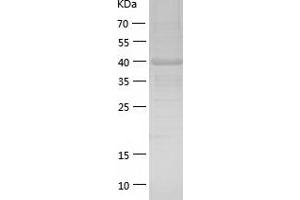 Western Blotting (WB) image for Sorbitol Dehydrogenase (SORD) (AA 1-357) protein (His tag) (ABIN7125174) (SORD Protein (AA 1-357) (His tag))