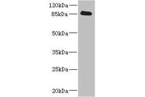 Western Blotting (WB) image for anti-Cadherin 1, Type 1, E-Cadherin (Epithelial) (CDH1) (AA 20-260) antibody (ABIN7146200)