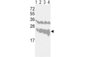 Western blot analysis of PGP9. (UCHL1 Antikörper  (AA 16-46))