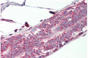 Human Breast (formalin-fixed, paraffin-embedded) stained with PHB2 antibody ABIN337044 at 5 ug/ml followed by biotinylated goat anti-rabbit IgG secondary antibody ABIN481713, alkaline phosphatase-streptavidin and chromogen. (Prohibitin 2 Antikörper  (AA 88-299))