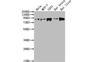 Western Blot Positive WB detected in: Hela whole cell lysate, MCF-7 whole cell lysate, U251 whole cell lysate, Rat brain tissue, Rat liver tissue All lanes: VCP antibody at 1:2000 Secondary Goat polyclonal to rabbit IgG at 1/50000 dilution Predicted band size: 90 kDa Observed band size: 90 kDa (Rekombinanter VCP Antikörper)