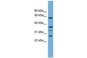 Image no. 1 for anti-Apolipoprotein L, 2 (APOL2) (C-Term) antibody (ABIN6746314) (Apolipoprotein L 2 Antikörper  (C-Term))