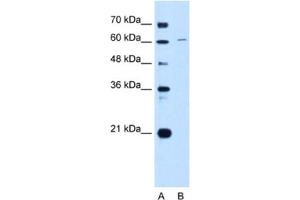 Western Blotting (WB) image for anti-Chromatin Licensing and DNA Replication Factor 1 (CDT1) antibody (ABIN2462973) (CDT1 Antikörper)