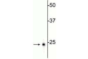 Western blot of rat hippocampal homogenate showing specific immunolabeling of the (UCHL1 Antikörper)
