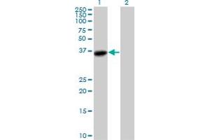 Western Blotting (WB) image for anti-Aldo-Keto Reductase Family 1, Member C3 (3-alpha Hydroxysteroid Dehydrogenase, Type II) (AKR1C3) (AA 1-323) antibody (ABIN522092)