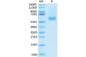 Biotinylated Human BAFF (Trimer) on Tris-Bis PAGE under reduced condition. (BAFF Protein (Trimer) (His-Avi Tag,Biotin))