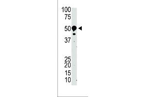Western Blotting (WB) image for anti-Suppressor of Variegation 3-9 Homolog 2 (Drosophila) (SUV39H2) (AA 93-122), (N-Term) antibody (ABIN388081)