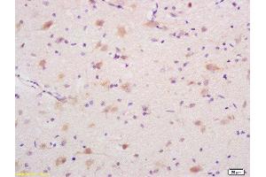 Formalin-fixed and paraffin embedded rat brain labeled with Rabbit Anti DEDD1 Polyclonal Antibody, Unconjugated  at 1:200 followed by conjugation to the secondary antibody and DAB staining (DEDD Antikörper  (AA 151-250))