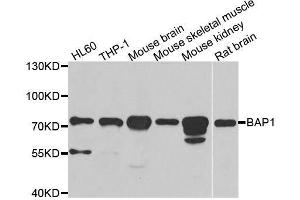 Western blot analysis of extracts of various cell lines, using BAP1 antibody. (BAP1 Antikörper  (AA 460-729))