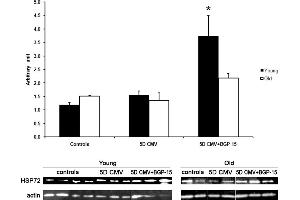Western blot analyses of the Hsp72 protein expression normalized to actin contents in the diaphragm in control animals (individual rats: young n = 4 and old emphn = 2) compared with the age-matched animals exposed to CMV for 5 days with (individual rats: young n = 3 and old n = 2) and without BGP-15 (individual rats: young n = 3 and old n = 3). (HSP70 Antikörper)