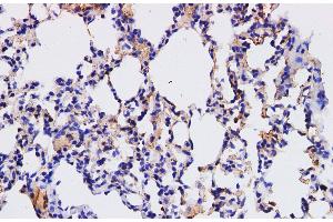 Immunohistochemistry of paraffin-embedded Mouse lung using HPGD Polyclonal Antibody at dilution of 1:200 (HPGD Antikörper)
