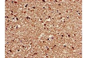 Immunohistochemistry of paraffin-embedded human brain tissue using ABIN7175571 at dilution of 1:100 (CACNG3 Antikörper  (AA 235-315))