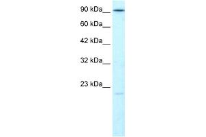 WB Suggested Anti-LIG4 Antibody Titration:  1. (LIG4 Antikörper  (N-Term))