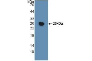 Detection of Recombinant GSTm1, Human using Polyclonal Antibody to Glutathione S Transferase Mu 1 (GSTM1) (GSTM1 Antikörper  (AA 1-218))