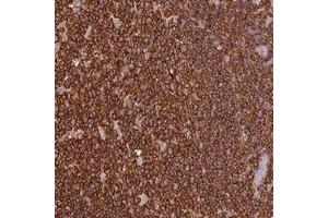 Immunohistochemical staining of human tonsil with OR6P1 polyclonal antibody  shows strong cytoplasmic positivity in germinal and non-germinal center cells at 1:20-1:50 dilution. (OR6P1 Antikörper)