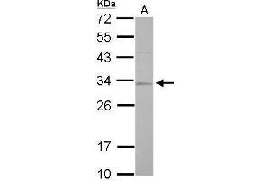 WB Image RPA32 antibody detects RPA2 protein by Western blot analysis.