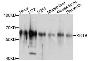 Western blot analysis of extracts of various cell lines, using KRT9 antibody. (KRT9 Antikörper  (AA 150-450))