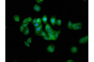 Immunofluorescence staining of HepG2 cells with ABIN7159750 at 1:133, counter-stained with DAPI. (MAP1A Antikörper  (AA 1979-2168))